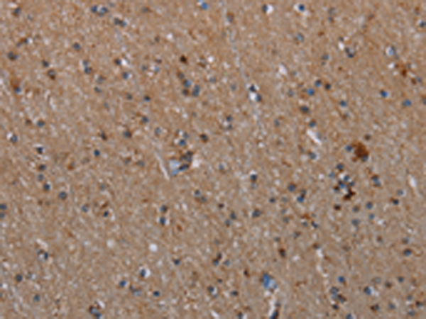 Anti-MMP23B Rabbit Polyclonal Antibody