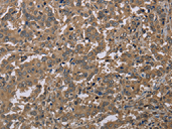 Anti-CAB39 Rabbit Polyclonal Antibody