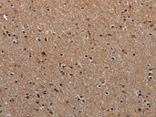 Anti-NDUFA8 Rabbit Polyclonal Antibody