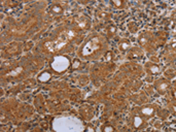 Anti-NDUFS2 Rabbit Polyclonal Antibody