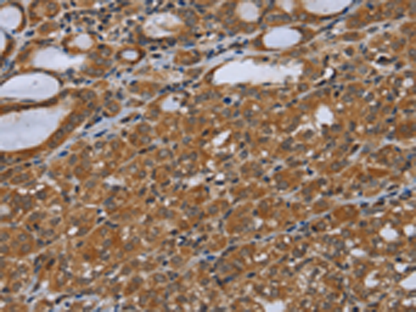 Anti-NIRF Rabbit Polyclonal Antibody