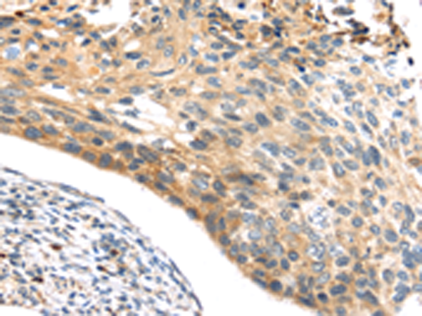 Anti-NOX3 Rabbit Polyclonal Antibody