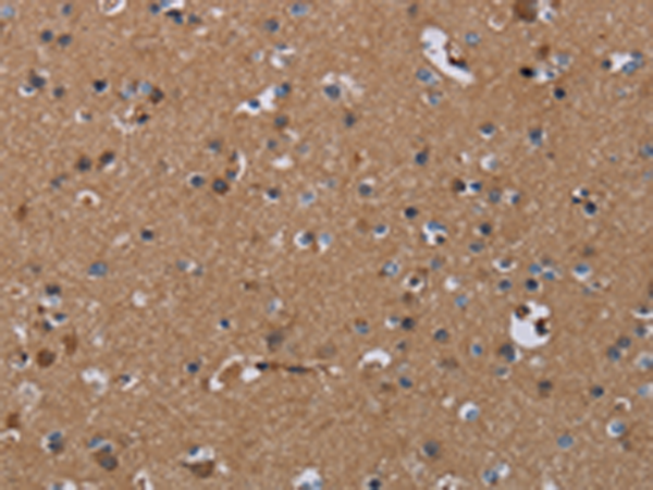 Anti-PDE4A Rabbit Polyclonal Antibody
