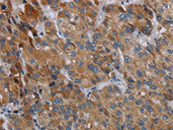 Anti-PDSS2 Rabbit Polyclonal Antibody