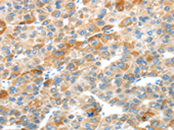 Anti-Plexin B2 Rabbit Polyclonal Antibody