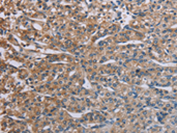 Anti-PLXND1 Rabbit Polyclonal Antibody