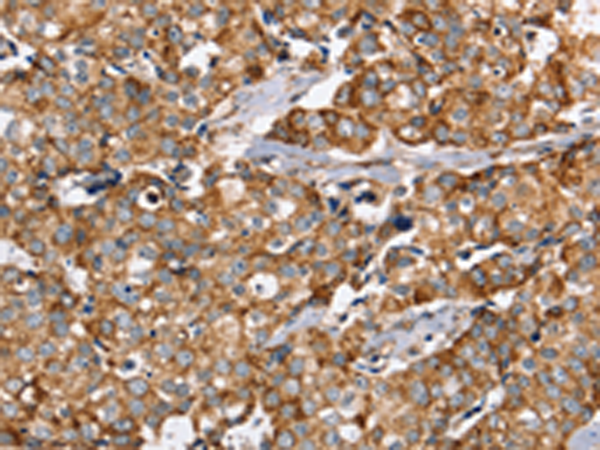 Anti-PPOX Rabbit Polyclonal Antibody