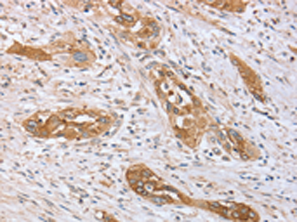Anti-PPP2R3A Rabbit Polyclonal Antibody