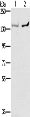 Anti-PPP2R3A Rabbit Polyclonal Antibody