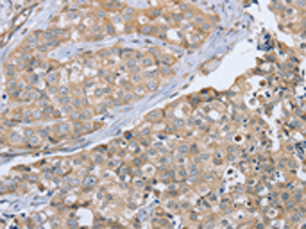 Anti-CYTH1 Rabbit Polyclonal Antibody