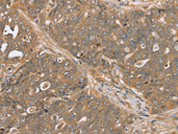 Anti-PTPN20B Rabbit Polyclonal Antibody