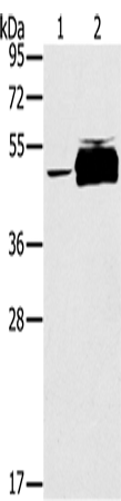 Anti-PTPN20B Rabbit Polyclonal Antibody