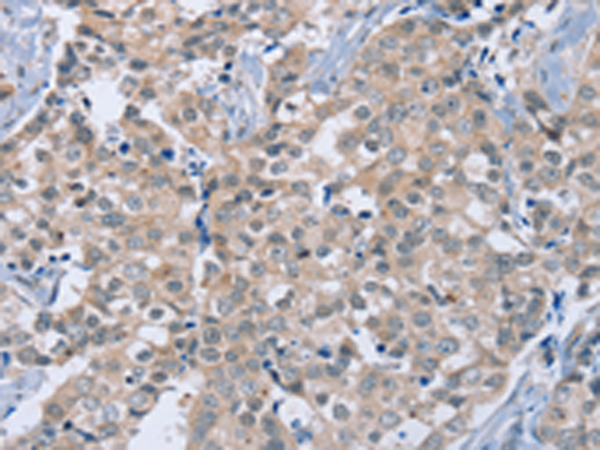 Anti-Rab8B Rabbit Polyclonal Antibody