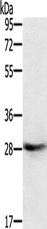 Anti-Rab8B Rabbit Polyclonal Antibody