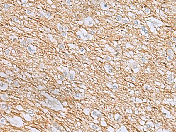 Anti-RHCG Rabbit Polyclonal Antibody