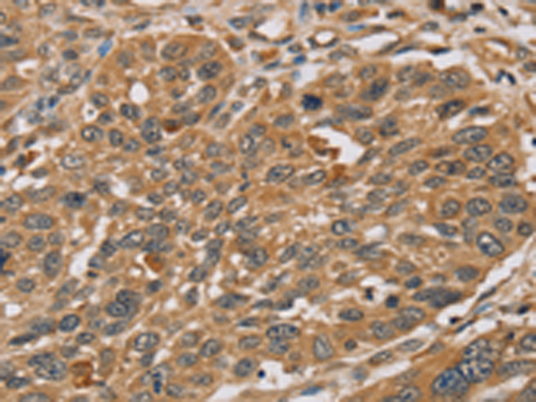 Anti-RNF5 Rabbit Polyclonal Antibody