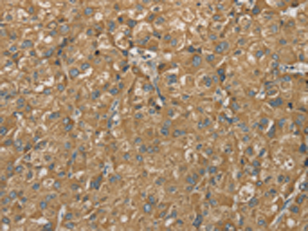 Anti-SDHB Rabbit Polyclonal Antibody