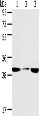 Anti-SDHB Rabbit Polyclonal Antibody