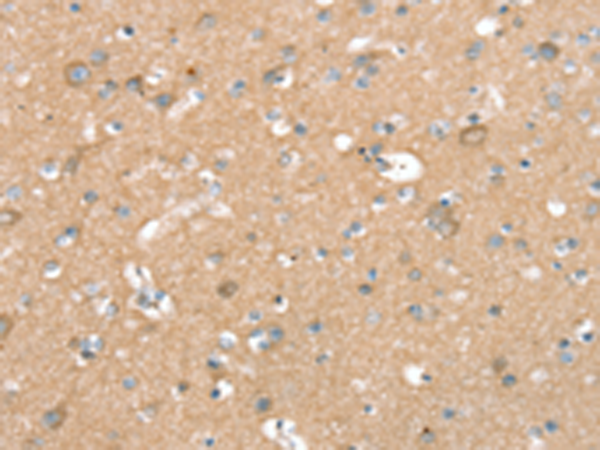 Anti-SEPN1 Rabbit Polyclonal Antibody