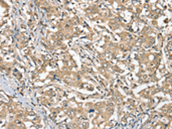 Anti-SGPL1 Rabbit Polyclonal Antibody