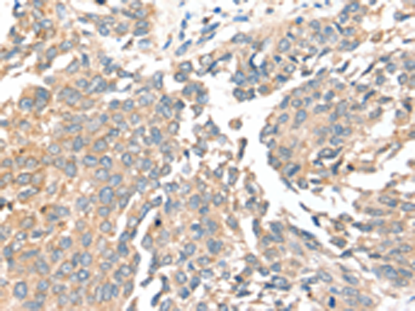 Anti-SIRT4 Rabbit Polyclonal Antibody