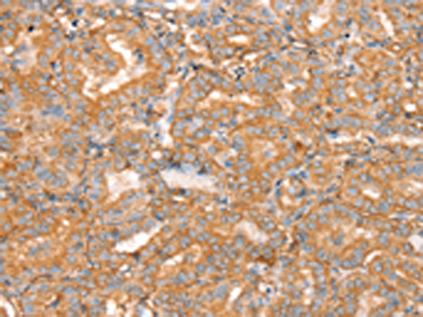 Anti-SLC16A8 Rabbit Polyclonal Antibody