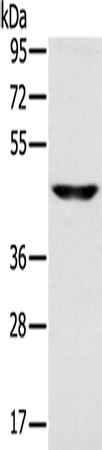 Anti-SLC16A8 Rabbit Polyclonal Antibody