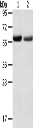 Anti-SLC16A9 Rabbit Polyclonal Antibody