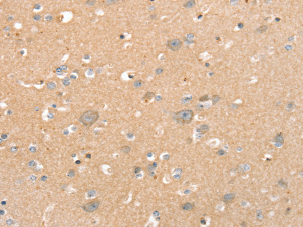 Anti-SLC41A2 Rabbit Polyclonal Antibody