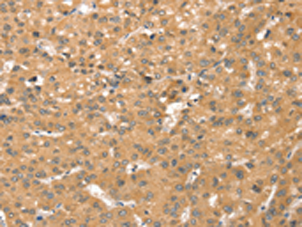 Anti-SMC6 Rabbit Polyclonal Antibody