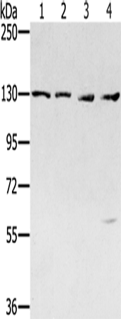 Anti-SMC6 Rabbit Polyclonal Antibody