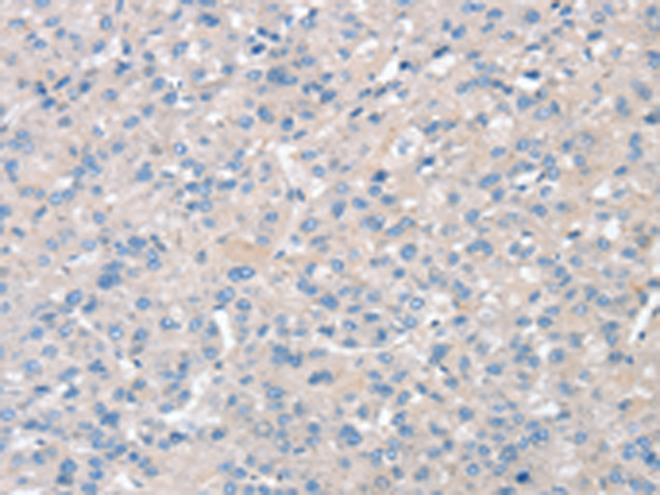 Anti-SNX3 Rabbit Polyclonal Antibody