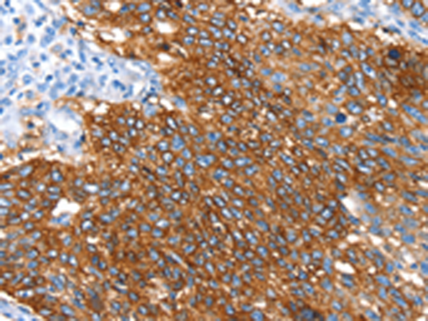 Anti-SNX5 Rabbit Polyclonal Antibody