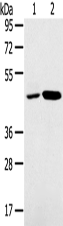 Anti-SNX5 Rabbit Polyclonal Antibody