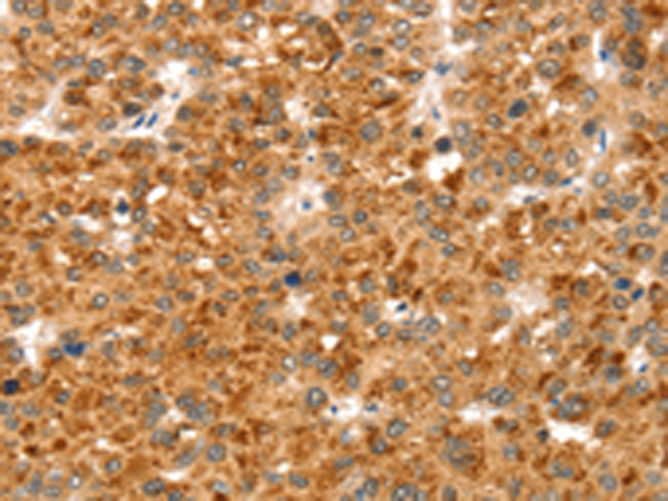 Anti-Superoxide Dismutase Copper Chaperone Rabbit Polyclonal Antibody