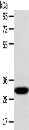 Anti-Superoxide Dismutase Copper Chaperone Rabbit Polyclonal Antibody