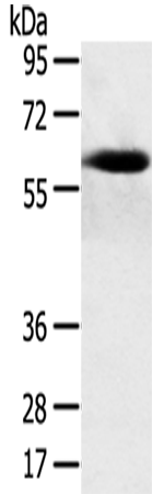 Anti-SPATA18 Rabbit Polyclonal Antibody