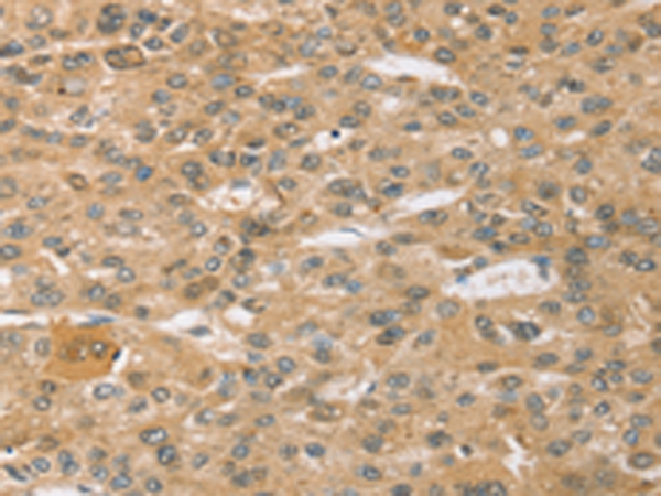 Anti-SPON1 Rabbit Polyclonal Antibody