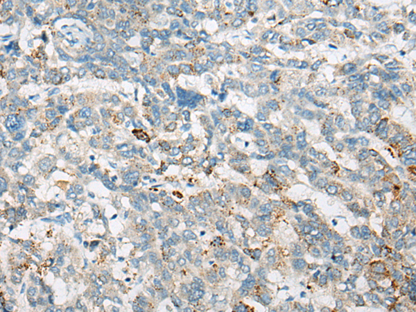 Anti-Steroid Sulfatase Rabbit Polyclonal Antibody