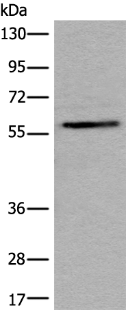 Anti-Steroid Sulfatase Rabbit Polyclonal Antibody