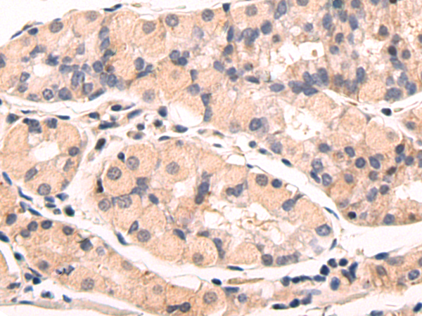 Anti-StARD4 Rabbit Polyclonal Antibody