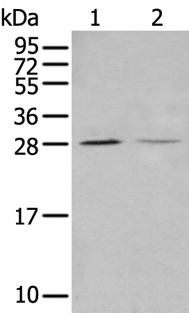 Anti-StARD4 Rabbit Polyclonal Antibody