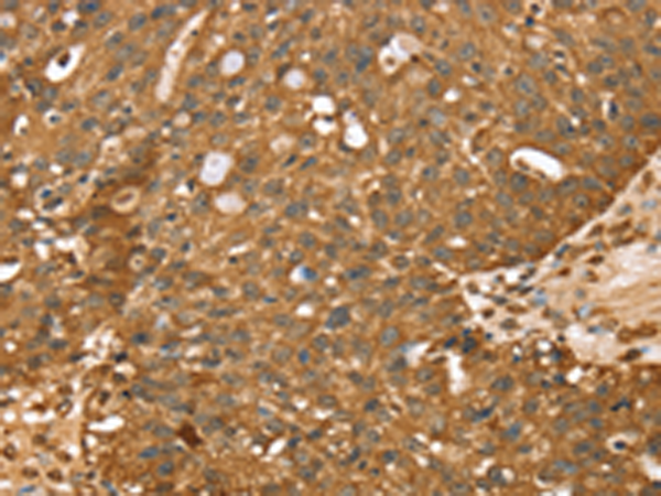Anti-StARD5 Rabbit Polyclonal Antibody