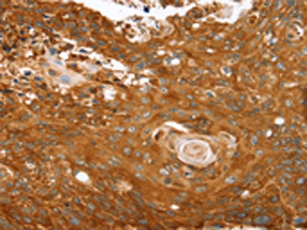 Anti-Sulfonylurea Receptor 1 Rabbit Polyclonal Antibody