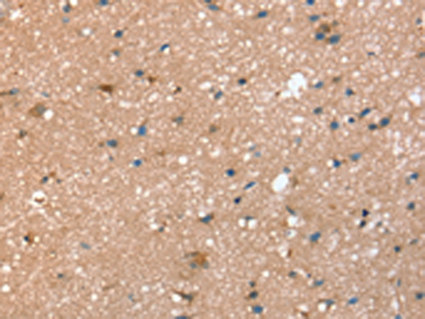 Anti-Syntaxin 2 Rabbit Polyclonal Antibody