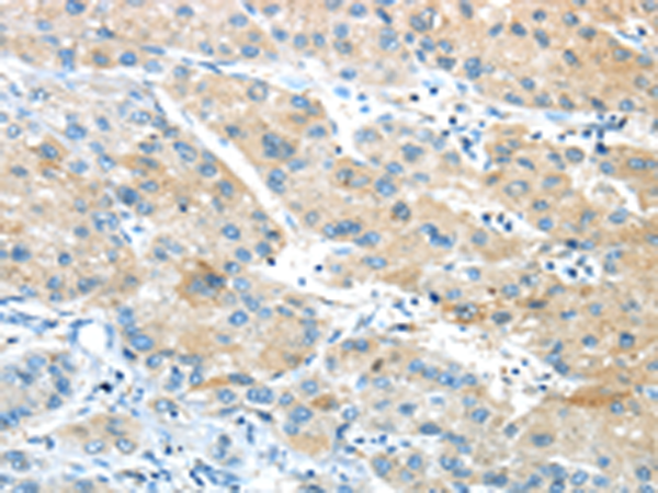 Anti-GPR15 Rabbit Polyclonal Antibody