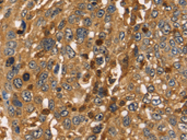 Anti-Thymosin beta 4 Rabbit Polyclonal Antibody
