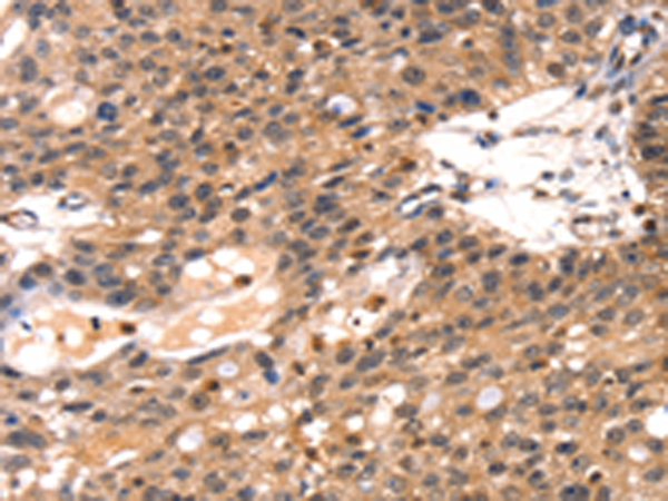Anti-Talin 1 Rabbit Polyclonal Antibody
