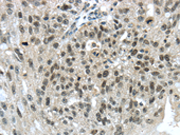 Anti-TRIM24 Rabbit Polyclonal Antibody
