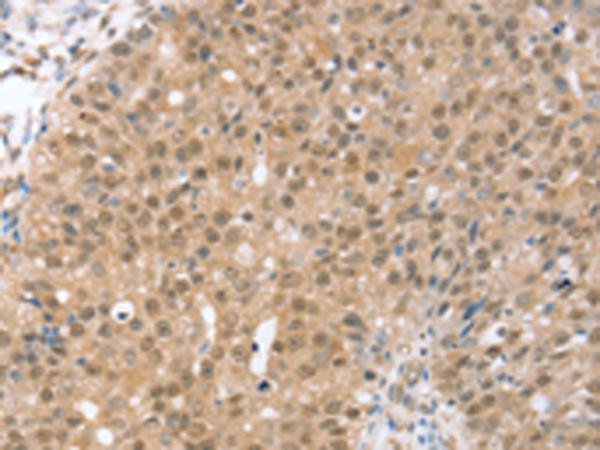Anti-TRIM35 Rabbit Polyclonal Antibody